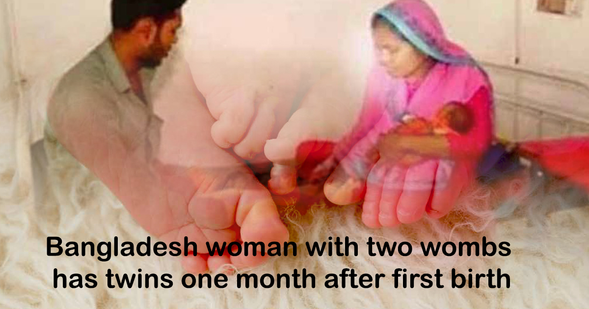 Women with Two Wombs Delivers Twins one Month after first Birth