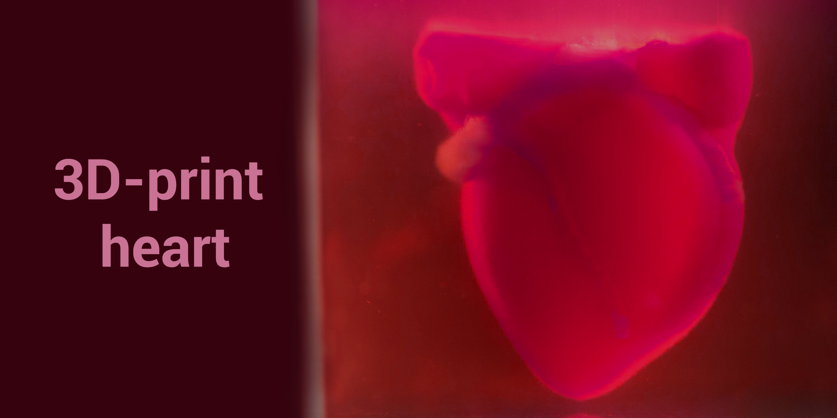 Human Patient’s Cells Used to create 3D-Printed Heart