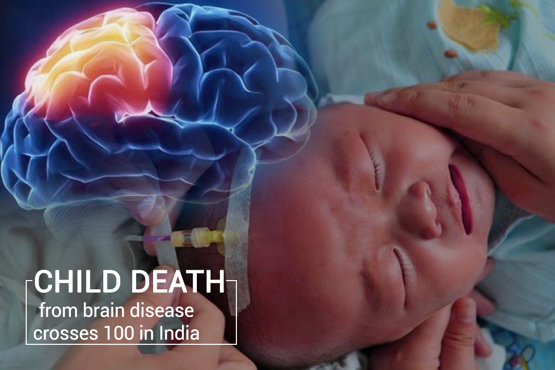 More than 100 Children died of Brain Disease in India