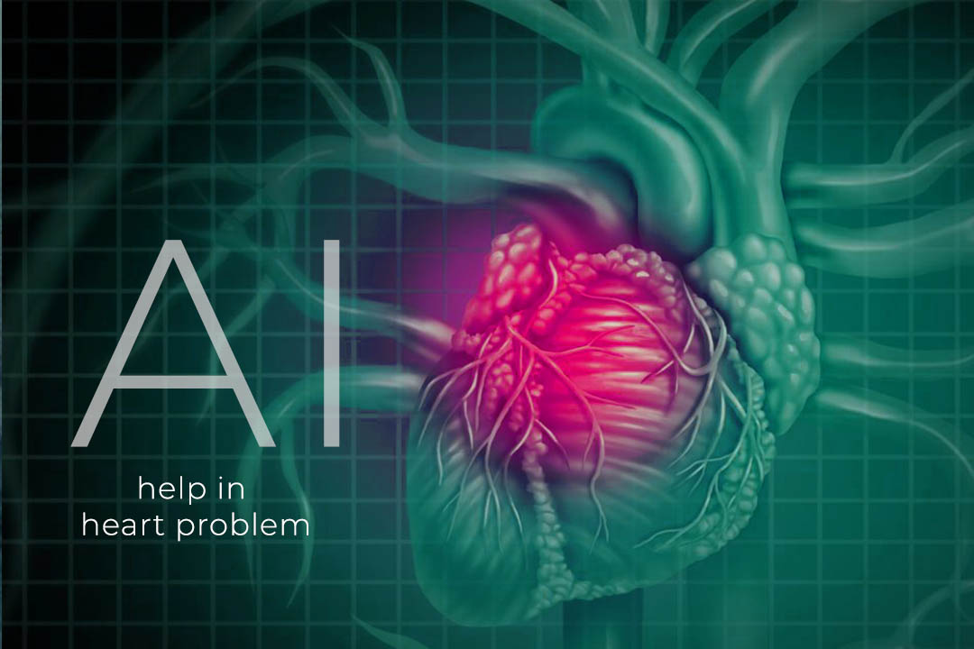 Artificial Intelligence Might Useful to Find Heart Issues