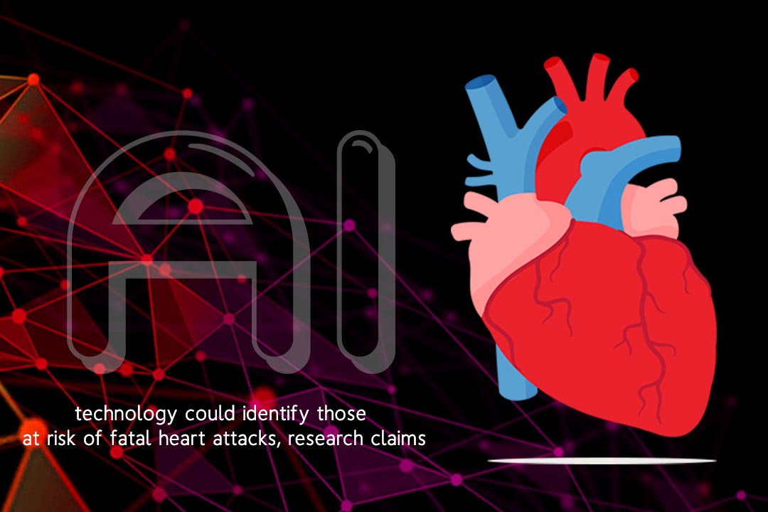 Artificial Intelligence might recognize fatal Heart Attack Risk